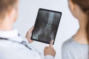 Chiropractor reviewing a lumbar spine X-ray with a patient on a tablet at a Holland, MI clinic