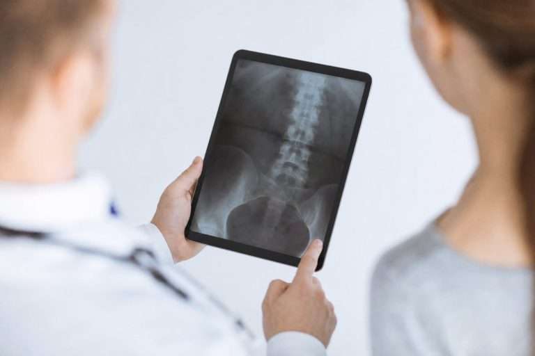 Chiropractor reviewing a lumbar spine X-ray with a patient on a tablet at a Holland, MI clinic